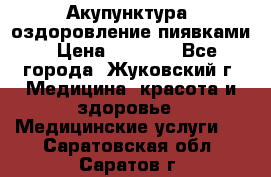 Акупунктура, оздоровление пиявками › Цена ­ 3 000 - Все города, Жуковский г. Медицина, красота и здоровье » Медицинские услуги   . Саратовская обл.,Саратов г.